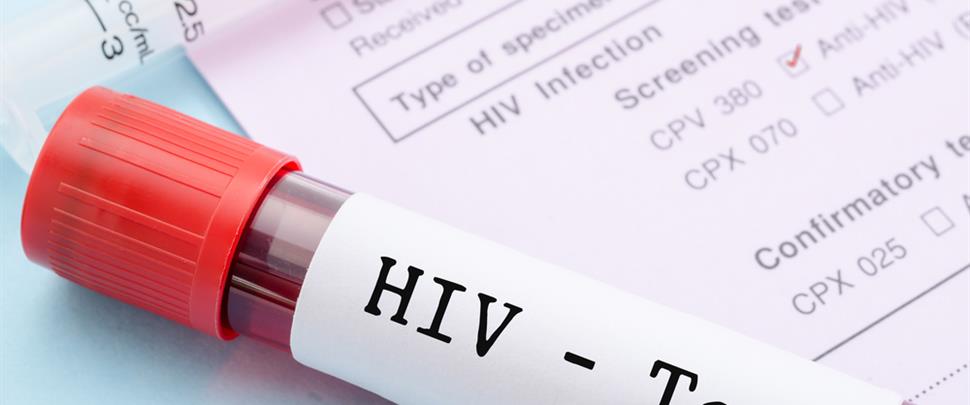 KULDĪGĀ HIV TESTU VARI VEIKT BEZ MAKSAS UN ANONĪMI